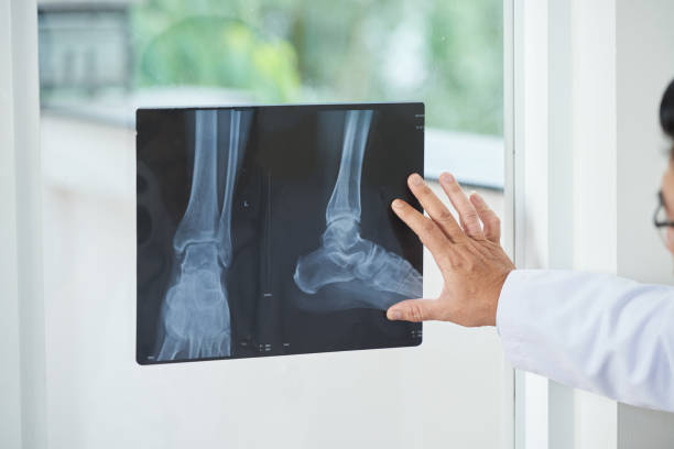 Crop doctor looking at X-ray picture Unrecognizable medical practitioner examining X-ray picture of legs near window in doctor's office ankle photos stock pictures, royalty-free photos & images
