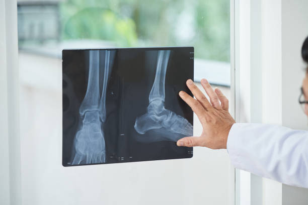 Crop doctor looking at X-ray picture Unrecognizable medical practitioner examining X-ray picture of legs near window in doctor's office examining x ray stock pictures, royalty-free photos & images