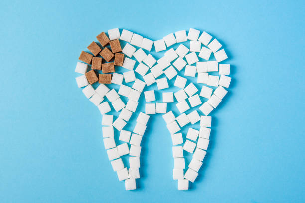Sugar destroys the tooth enamel and leads to tooth decay. Tooth made of white and caries made of brown sugar cubes. stock photo