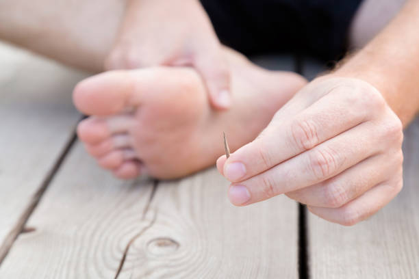 Young man's hand showing wooden splinter after removing it from foot. Accident on wooden floor after walking by barefoot. Front view. Close up. Young man's hand showing wooden splinter after removing it from foot. Accident on wooden floor after walking by barefoot. Front view. Close up. sliver stock pictures, royalty-free photos & images