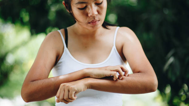 las mujeres jóvenes mano cero picor en el brazo, cuidado de la salud - itchy skin fotografías e imágenes de stock