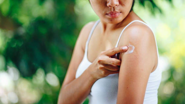 istock Young women hand scratch the itch on the arm 1032681836