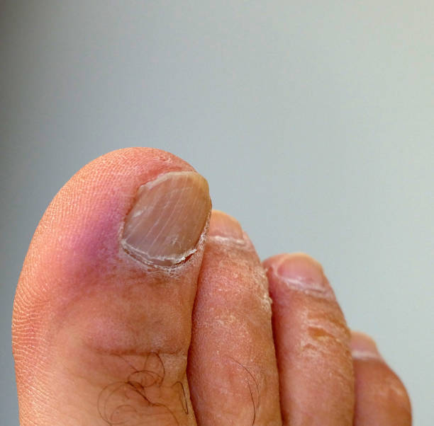 istock foot and fingers close-up 1032802152