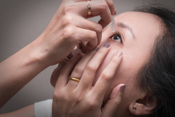 asian young woman uses eye drops for eye treatment. redness, dry eyes, allergy and eye itching - antibiotic red medicine healthcare and medicine imagens e fotografias de stock