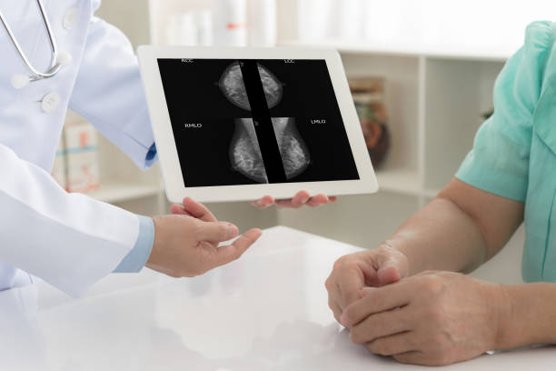 arzt und patient röntgenaufnahmen der brust - mammogram mri scan breast breast examination stock-fotos und bilder