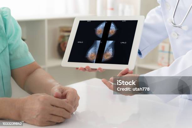 Breast Cancer Breaststroke Stock Photo - Download Image Now - Breast Cancer, Breast, Mammogram