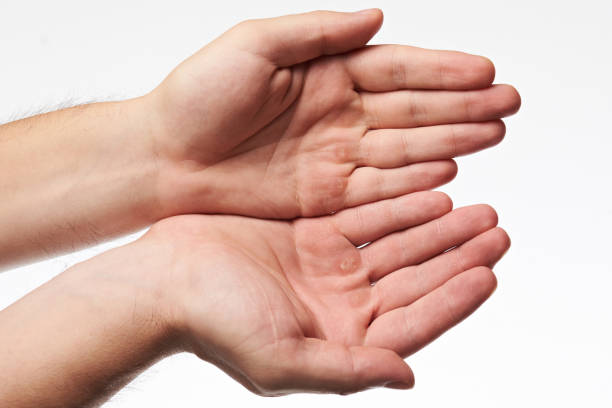 istock Female hands with  blister 1033552816