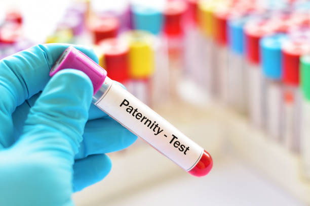 Blood sample for paternity test stock photo