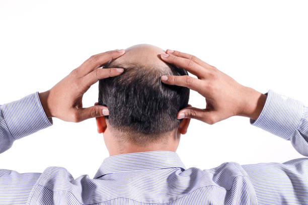 bald businessman with his head on scalp view from behind with white background - completely bald fotos imagens e fotografias de stock