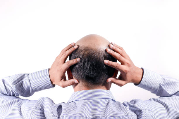 bald businessman with his head on scalp view from behind with white background - completely bald fotos imagens e fotografias de stock