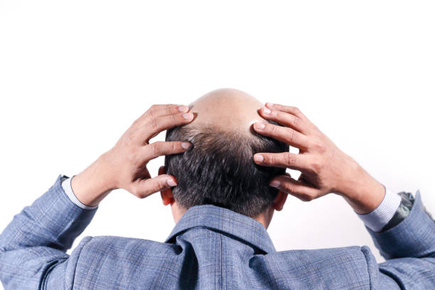 bald businessman with his head on scalp view from behind with white background - completely bald fotos imagens e fotografias de stock