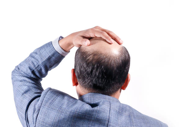 bald businessman with his head on scalp view from behind with white background - shaved head imagens e fotografias de stock