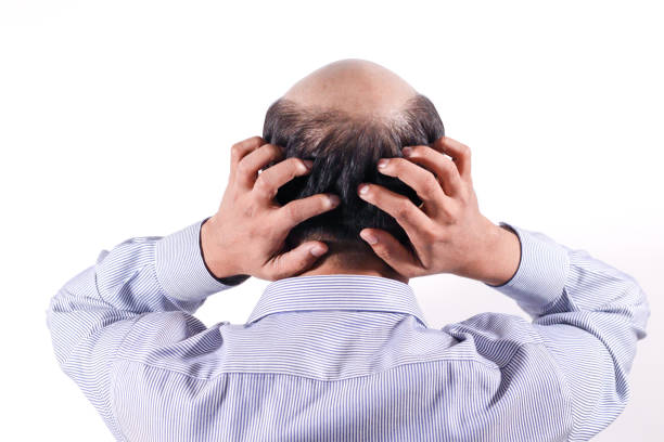 bald businessman with his head on scalp view from behind with white background - completely bald imagens e fotografias de stock