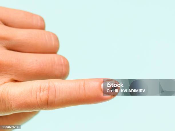 Knifedamaged Index Finger Of The Left Female Hand On A Light Blue Background Stock Photo - Download Image Now