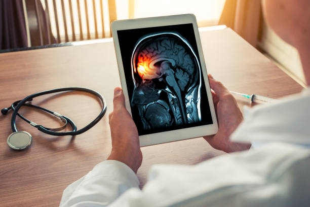 doutor, segurando um tablet digital com raio-x do cérebro e crânio esqueleto. conceito de dor de cabeça, meningite e enxaqueca - meningite - fotografias e filmes do acervo