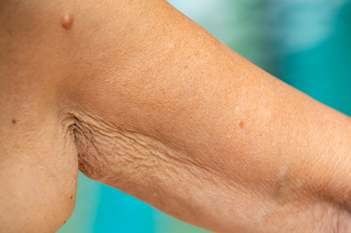 Senior woman raising her wrinkled inside part of the arm, Wrinkled armpit, Mole, Blue swimming pool background, Body concept, Close up