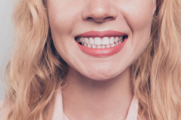 colheita de perto retrato metade do rosto de mulher com cabelo loiro e brilhante sorriso radiante estando no dentista - half smile - fotografias e filmes do acervo