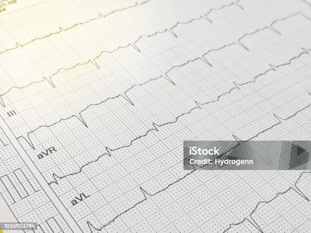 Electrocardiography Stock Photo - Download Image Now - Electrocardiography, Cardiac Arrhythmia, Cardiologist