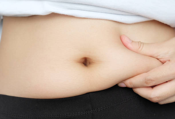 istock Side of woman hand catching fat body belly paunch , diabetic risk factor 1036483732