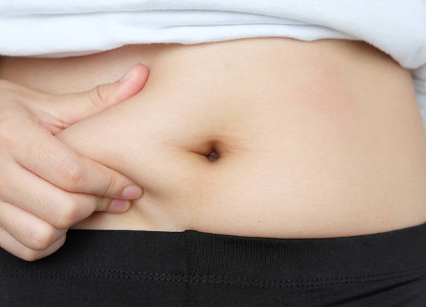 istock Side of woman hand catching fat body belly paunch , diabetic risk factor 1036485142