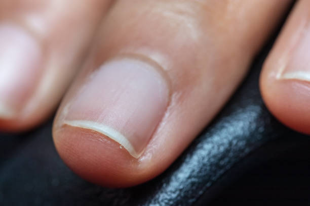 istock Close Up The woman's nails are on a black background. 1036892794