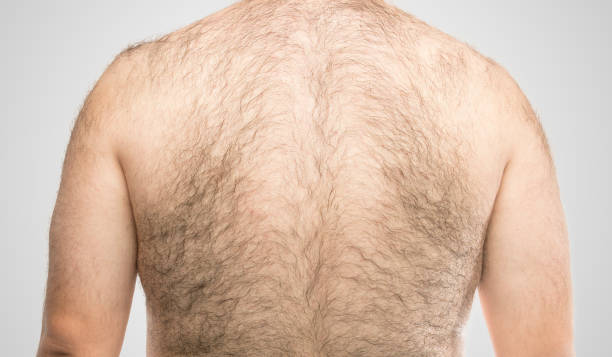 a hairy back a hairy back hairy fat man pictures stock pictures, royalty-free photos & images