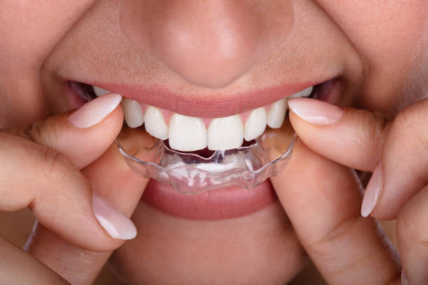 istock Woman Putting Transparent Aligner In Teeth 1037081066