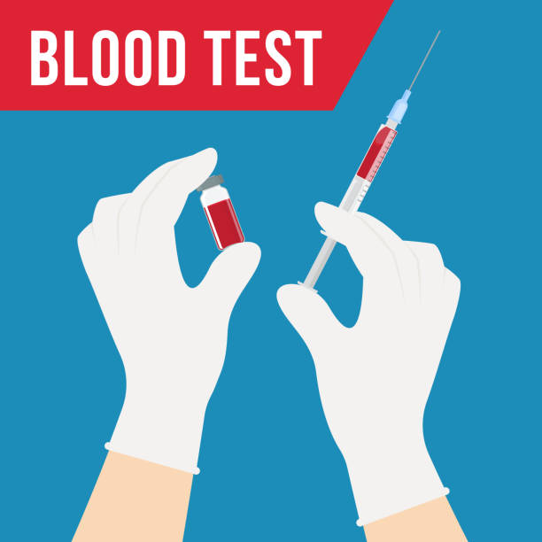 Health care and medical Syringe and ampoule with a blood in the hands of a doctor. Doctor makes blood collection for blood test, dna test, medical examination. Vector malaria blood sample stock illustrations