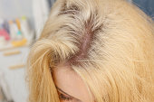 frau-mit-blonden-haarwurzeln.jpg?b=1&s=170x170&k=20&c=X-8u5TIOGdb6KBRpUDLNsADKKojNSyrKAtvLJUK6VKc=