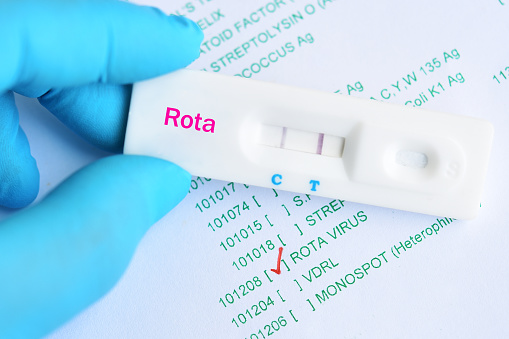 Rotavirus positive test result