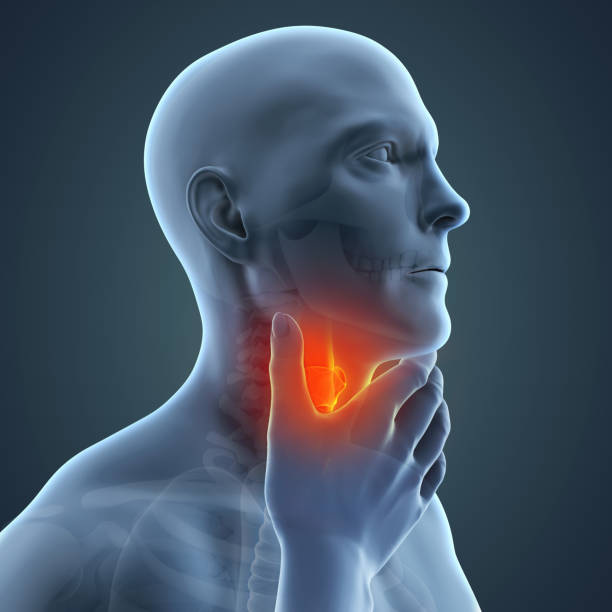 istock Sore Throat Illustration 1039095374
