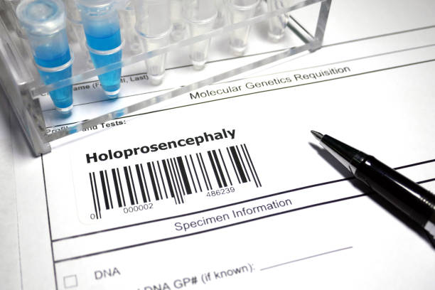 istock Holoprosencephaly genetic test 1039342942