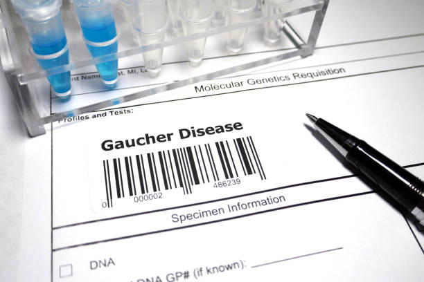 istock Gaucher's disease 1039344042