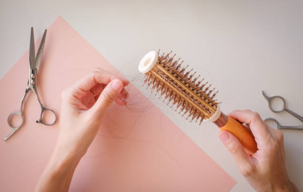 istock hair fall and lost alopecia woman problem on the comb. 1039473664