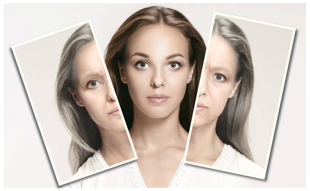 Comparison of aging skin