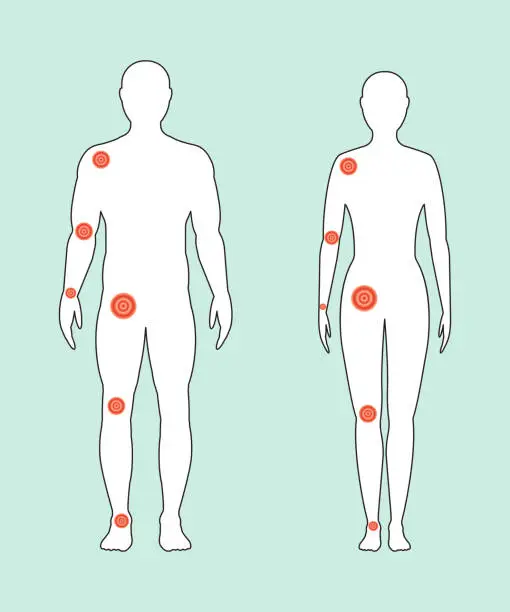 Vector illustration of Male and female contour with a painful joints. Vector illustration.