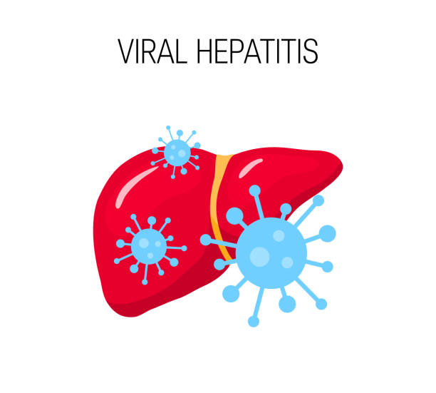 Viral hepatitis vector concept Viral hepatitis concept. Vector illustration of a unhealthy liver in flat style liver failure stock illustrations