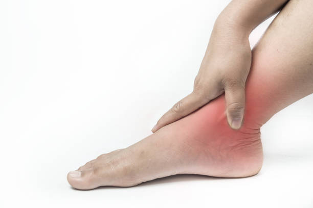 ankle injury in humans .ankle pain,joint pains people medical . stock photo