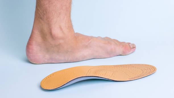 vänster ben av en vuxen man med tecken av mul bredvid ortopediska sulan. medel för behandling av platta fötter. - plattfot bildbanksfoton och bilder