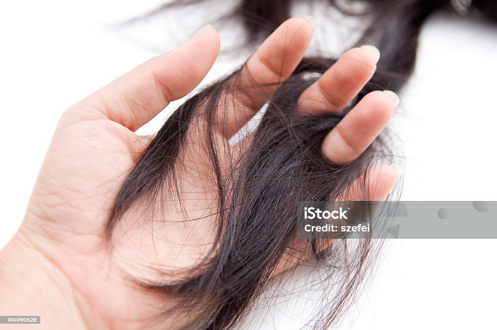 Hairloss  Balding Stock Photo