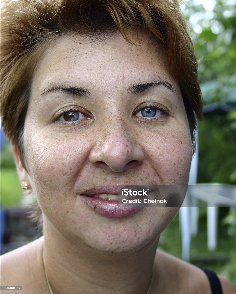 Freckles - Foto de stock de Adulto royalty-free