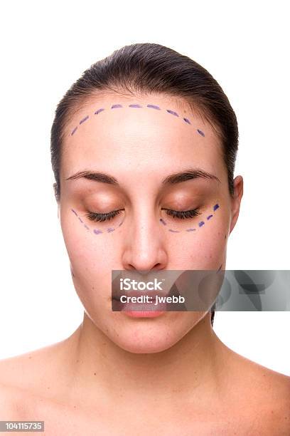 Gesichtstraffung Mit Kosmetische Chirurgie Stockfoto und mehr Bilder von Plastische Chirurgie - Plastische Chirurgie, Augen geschlossen, Besorgt