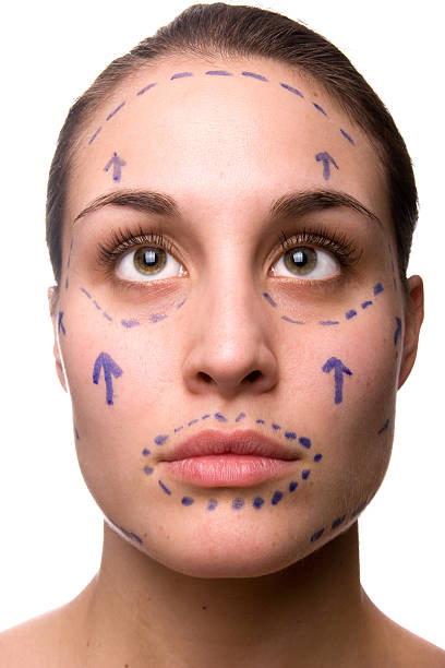 istock Lines for Cosmetic Surgery 104115782