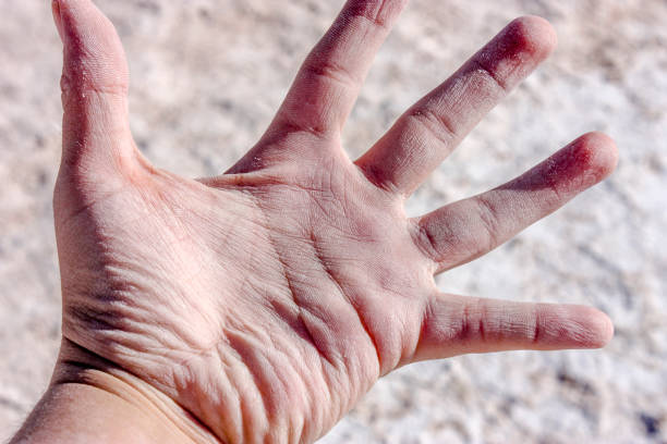 istock Dry hand after swim in a salt lagoon 1041585254