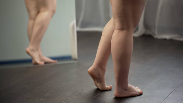 zwaarlijvige ladys voeten, ongezonde vrouw lijden overgewicht en spataderen - woman legs veins stockfoto's en -beelden