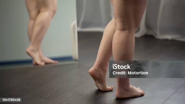 Obese Ladys Feet Unhealthy Woman Suffering Excess Weight And Varicose Veins Stock Photo - Download Image Now
