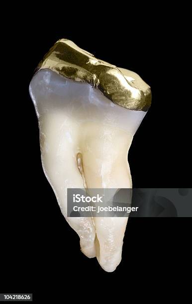 Молярный Зуб Человека — стоковые фотографии и другие картинки Золотой зуб - Золотой зуб, Без людей, Вертикальный