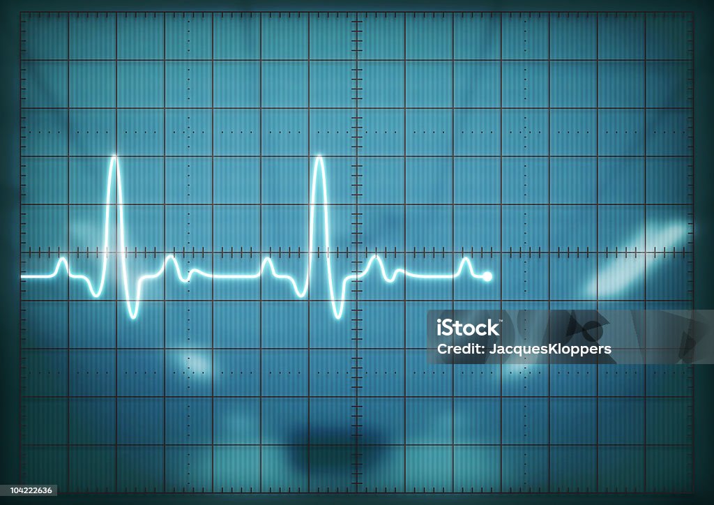 Oscilloscope screen showing heartbeat  Electrocardiography Stock Photo