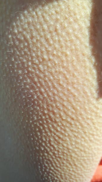 istock Goose bumps closeup 1042232398