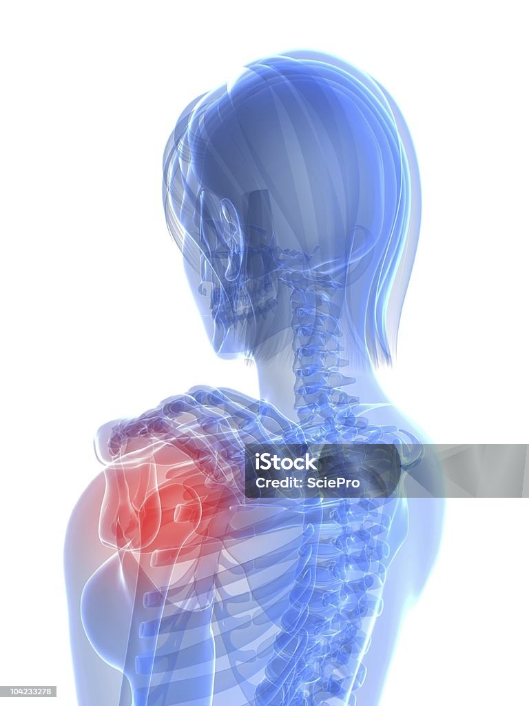 肩の痛み - 女性像のロイヤリティフリーストックフォト
